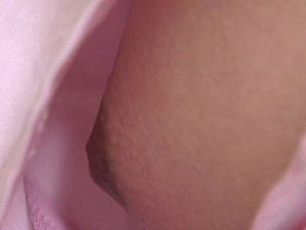 院内盗撮 外科病棟患者の仕掛けたスパイカメラ映像流出16人　サンプル画像03